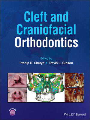 cover image of Cleft and Craniofacial Orthodontics
